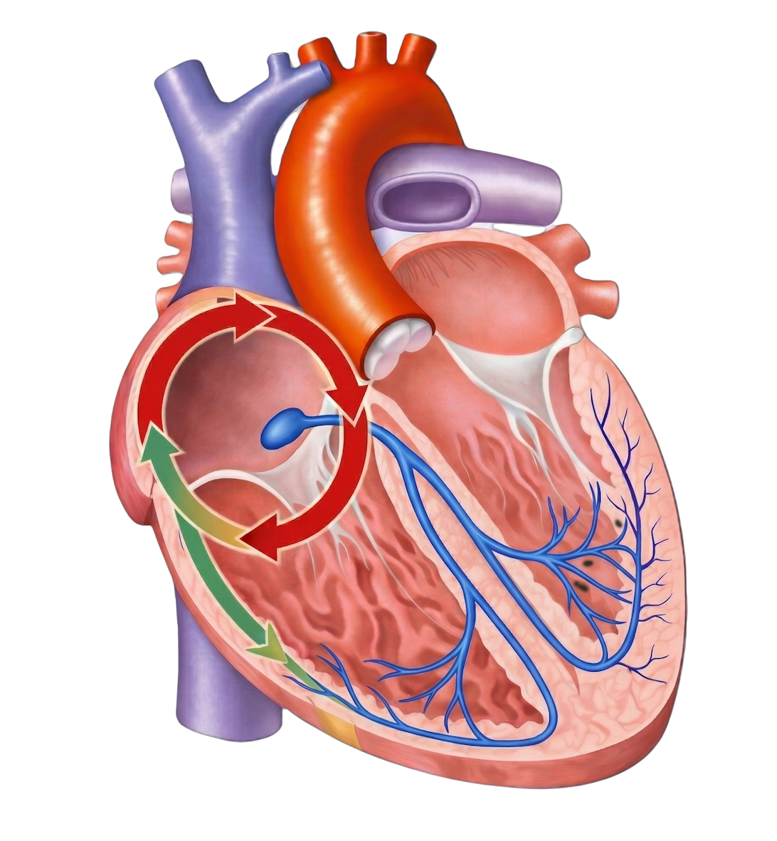 副伝導路を介したリエントリー回路(赤いループ)を示す心臓の刺激伝導系イラストで、PSVTの発生メカニズムを表現