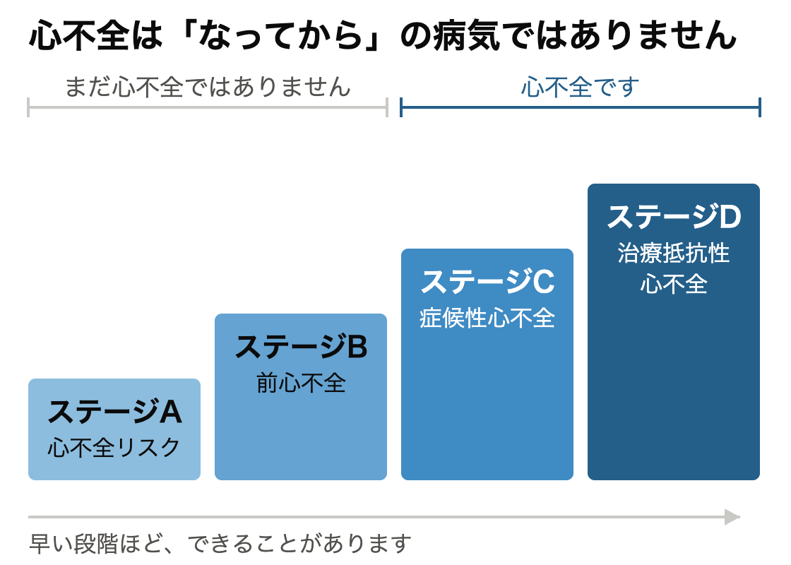 心不全のステージ分類。左からステージA(心不全リスク)、ステージB(前心不全)、ステージC(症候性心不全)、ステージD(治療抵抗性心不全)の順に段が高くなる階段の図。ステージAとBはまだ心不全ではなく、ステージCとDが心不全であることを示している