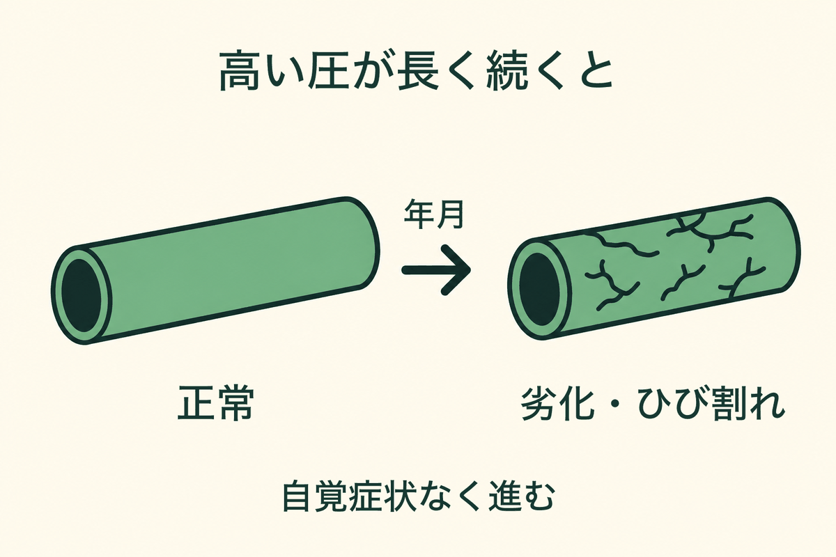 高血圧で血管が傷んでいく様子をゴムホースにたとえた図。左は正常な血管でなめらかな筒、右は高い圧が長く続いてひび割れた血管。自覚症状のないまま進むことを示している